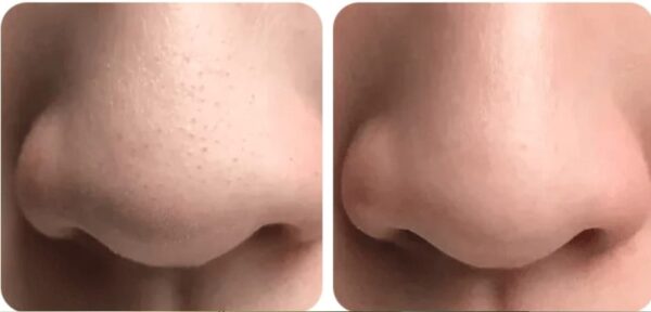 Mascarilla con Té Verde para Puntos Negros Bioaqua - Imagen 3